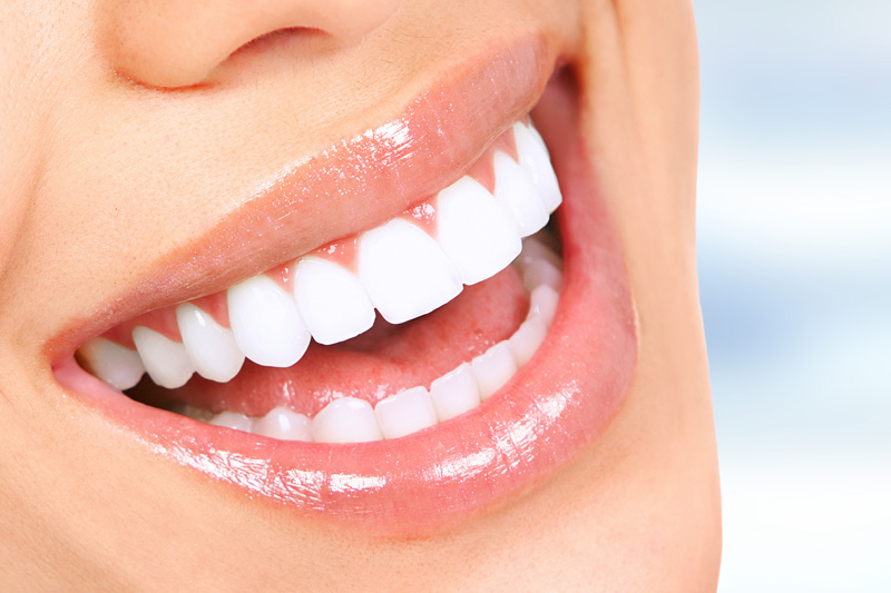 Cosmetic Dentistry in Seattle