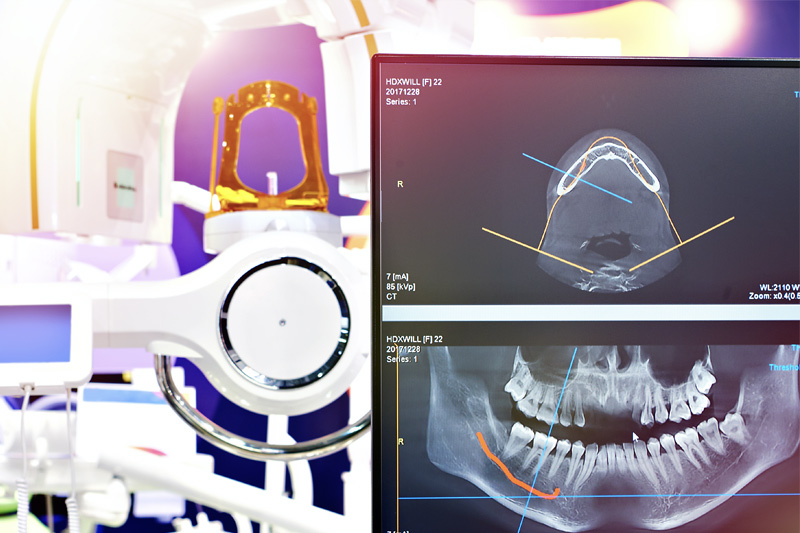 Digital X-Rays in 